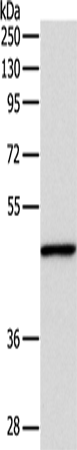 Rabbit Polyclonal Antibody to INHBA