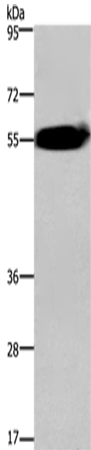 Rabbit Polyclonal Antibody to ACVR2A