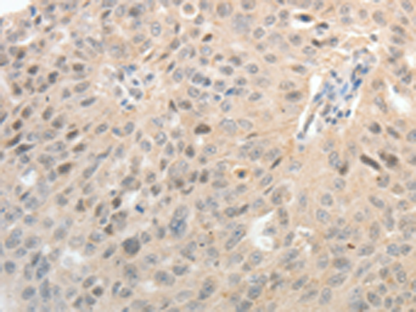 Rabbit Polyclonal Antibody to ASCL1