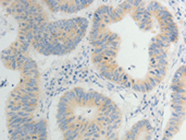 Rabbit Polyclonal Antibody to TP53BP2