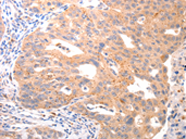 Rabbit Polyclonal Antibody to VTCN1