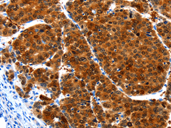 Rabbit Polyclonal Antibody to HIBADH