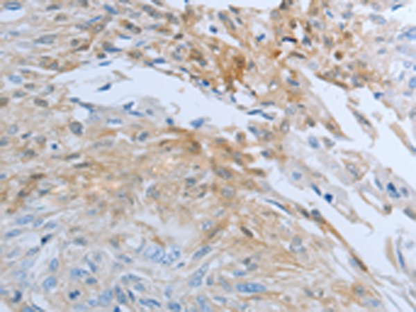 Rabbit Polyclonal Antibody to FGF1