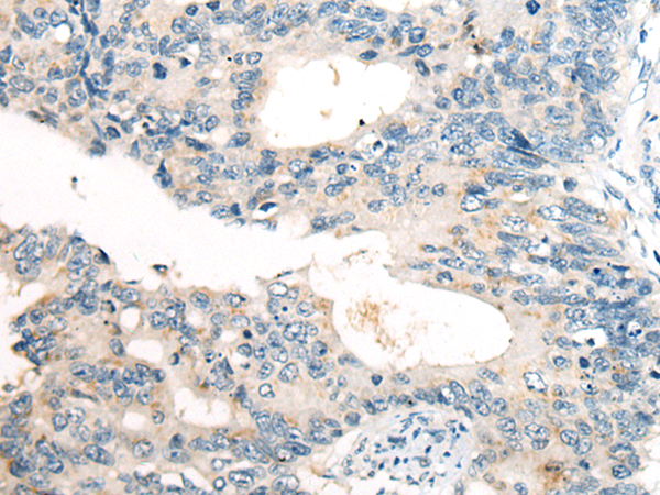 Rabbit Polyclonal Antibody to FGF5