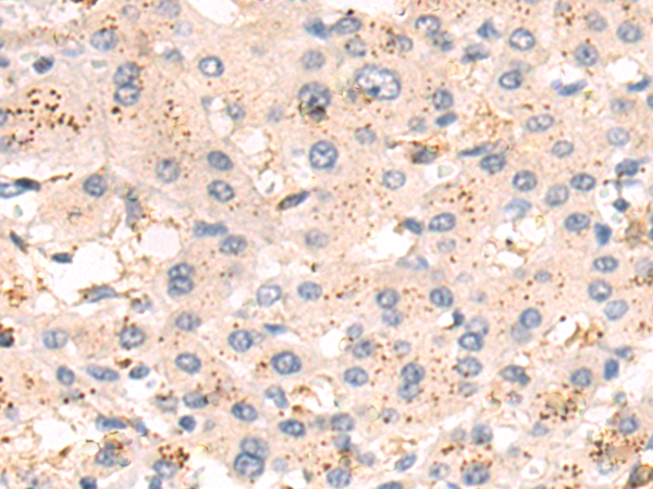 Rabbit Polyclonal Antibody to FGF7