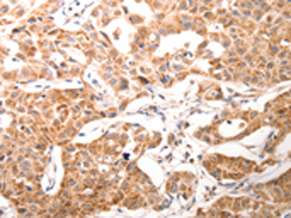 Rabbit Polyclonal Antibody to BGLAP