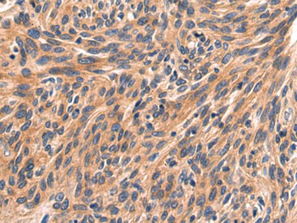 Rabbit Polyclonal Antibody to NPPB