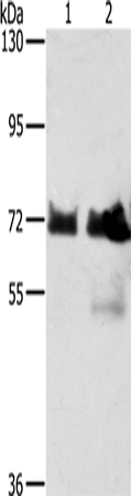 Rabbit Polyclonal Antibody to BRAF