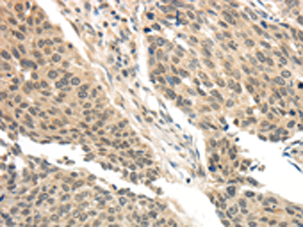 Rabbit Polyclonal Antibody to BRCA2