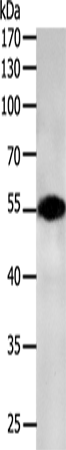Rabbit Polyclonal Antibody to CASP12