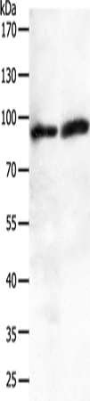 Rabbit Polyclonal Antibody to JUP