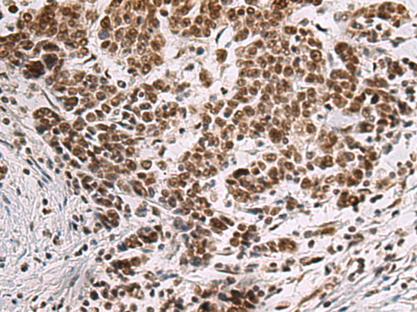 Rabbit Polyclonal Antibody to CREBBP