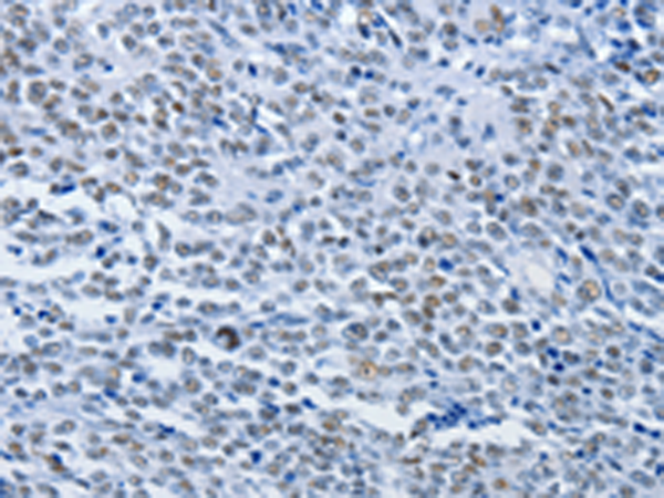 Rabbit Polyclonal Antibody to CBX1