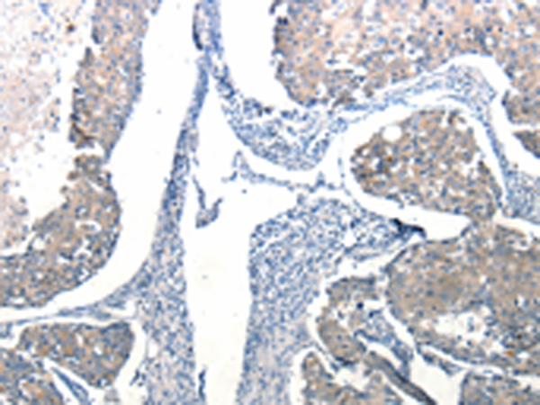 Rabbit Polyclonal Antibody to Ccl6