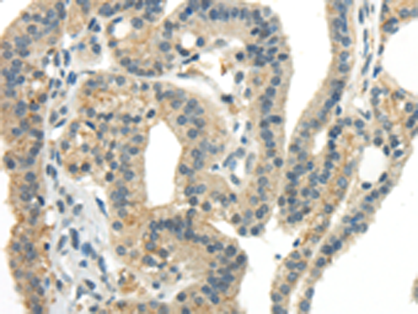 Rabbit Polyclonal Antibody to CCL13