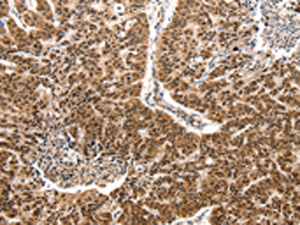 Rabbit Polyclonal Antibody to CCL2