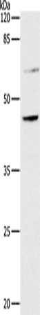 Rabbit Polyclonal Antibody to CCR7
