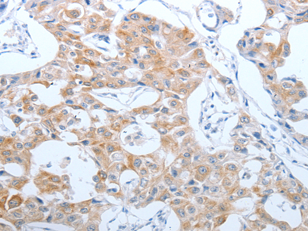 Rabbit Polyclonal Antibody to CEACAM5