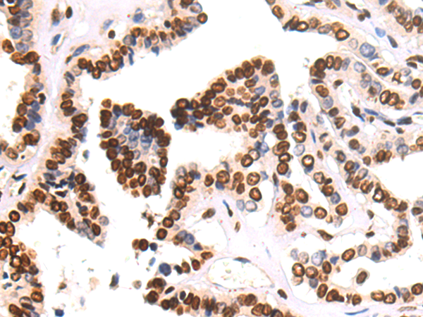 Rabbit Polyclonal Antibody to CEBPA