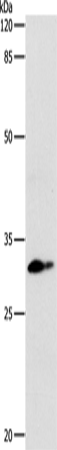 Rabbit Polyclonal Antibody to CEBPD