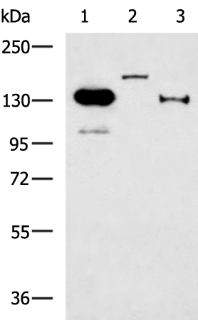 Rabbit Polyclonal Antibody to ERBB2