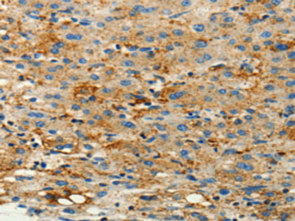 Rabbit Polyclonal Antibody to CFTR