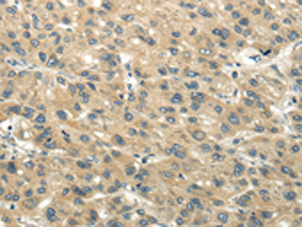 Rabbit Polyclonal Antibody to CHGB