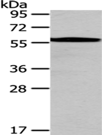 Rabbit Polyclonal Antibody to CHEK1