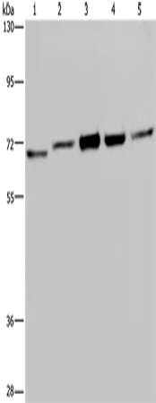 Rabbit Polyclonal Antibody to CHEK2