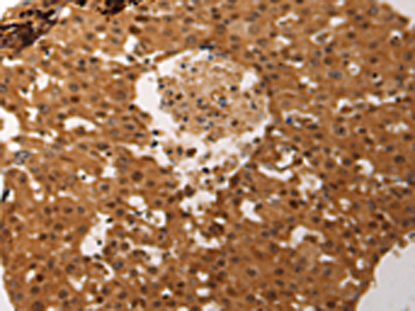 Rabbit Polyclonal Antibody to JUND