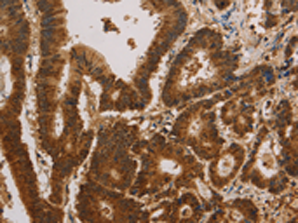 Rabbit Polyclonal Antibody to CSNK2B