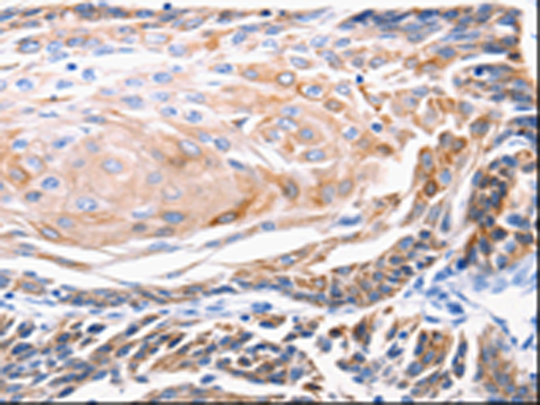 Rabbit Polyclonal Antibody to KRT5