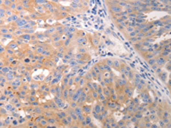 Rabbit Polyclonal Antibody to KRT6A/KRT6B/KRT6C