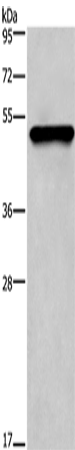 Rabbit Polyclonal Antibody to KRT14