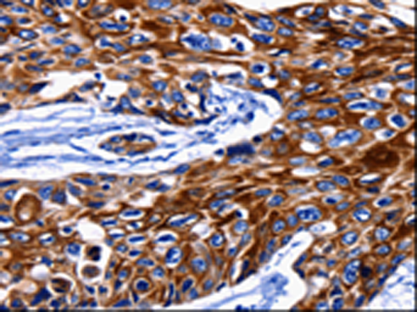Rabbit Polyclonal Antibody to KRT10