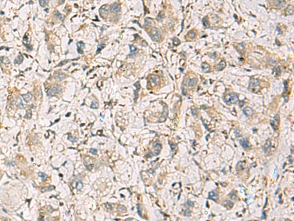 Rabbit Polyclonal Antibody to CMTM1