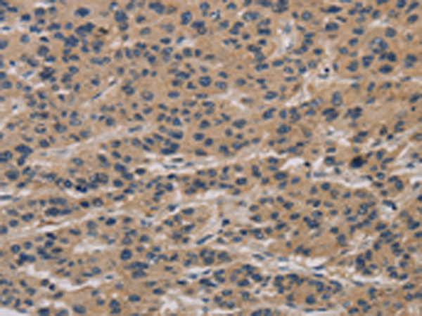 Rabbit Polyclonal Antibody to CLEC2A