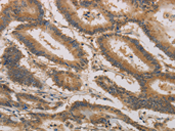 Rabbit Polyclonal Antibody to CLEC5A