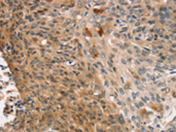 Rabbit Polyclonal Antibody to CNGA1