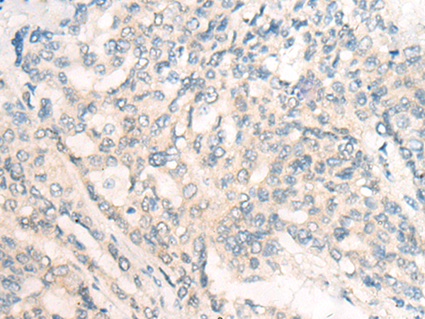 Rabbit Polyclonal Antibody to CNR1
