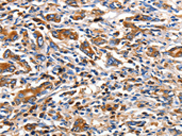 Rabbit Polyclonal Antibody to CLDN5