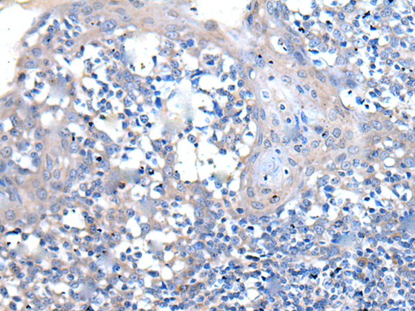 Rabbit Polyclonal Antibody to CLDN18