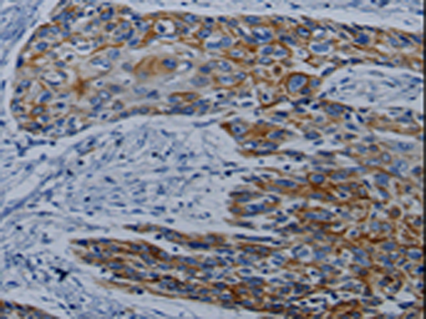 Rabbit Polyclonal Antibody to CPT2
