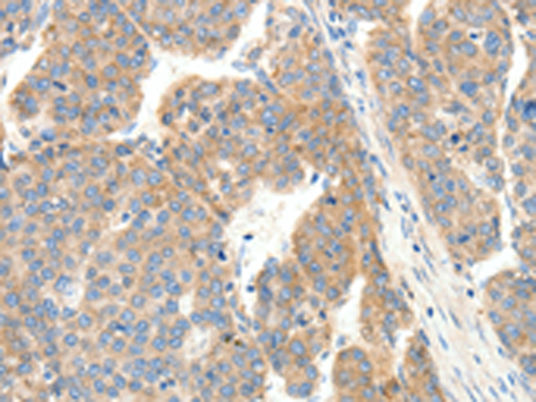 Rabbit Polyclonal Antibody to COL4A1