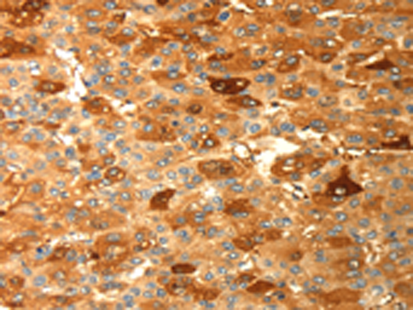 Rabbit Polyclonal Antibody to DPYSL2
