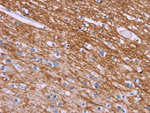 Rabbit Polyclonal Antibody to CRH