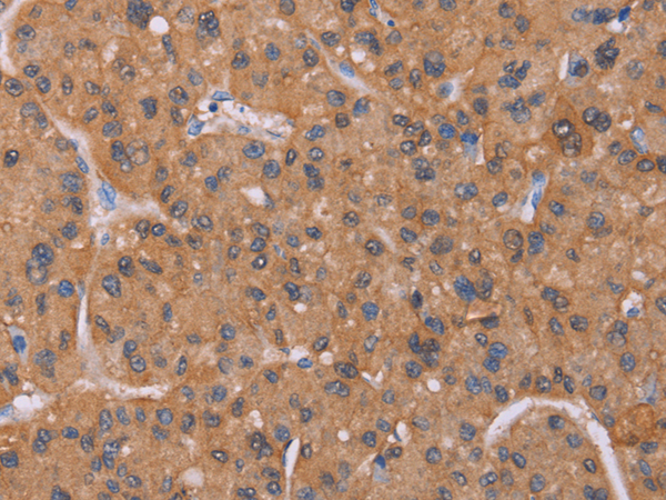 Rabbit Polyclonal Antibody to CALCA/CALCB