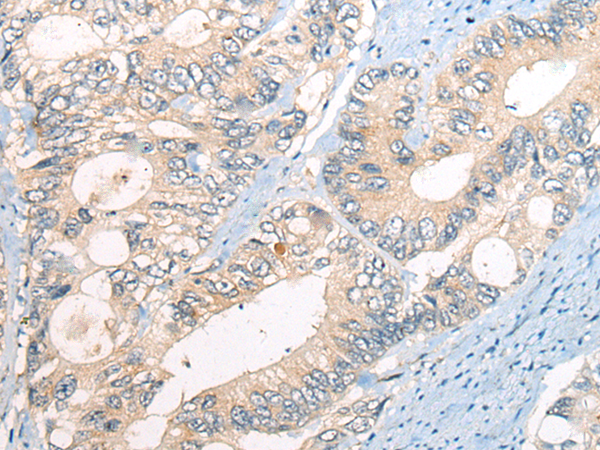 Rabbit Polyclonal Antibody to CTLA4