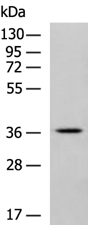 Rabbit Polyclonal Antibody to GJD2