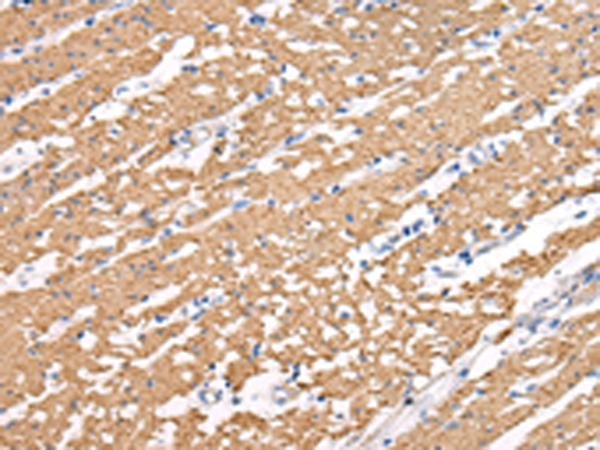 Rabbit Polyclonal Antibody to MIP